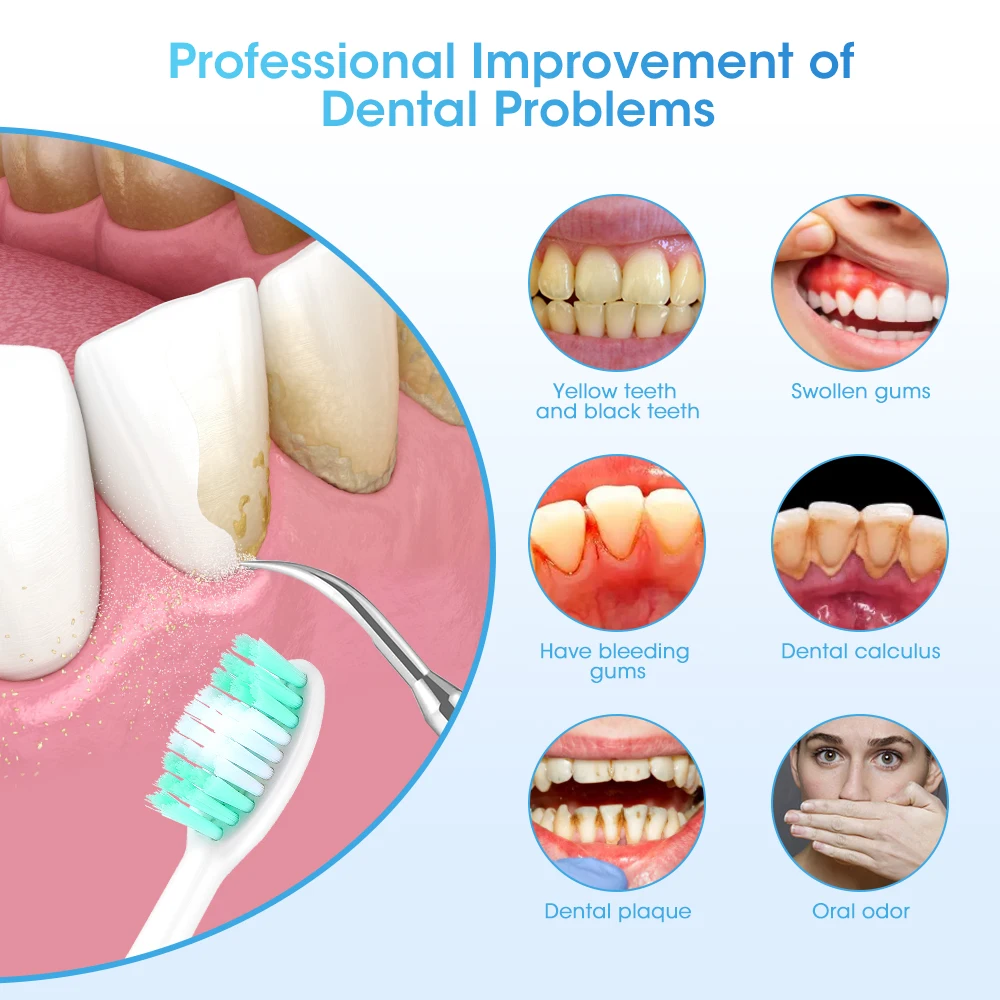 Electric Teeth Cleaner - Image 6